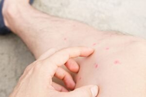 Kecil Tapi Berbahaya: Waspadai Efek Gigitan Kutu Kucing pada Manusia