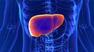 Sebagian Benar: Mengungkap Klaim Cara Penyembuhan Fatty Liver yang Sering Salah Kaprah