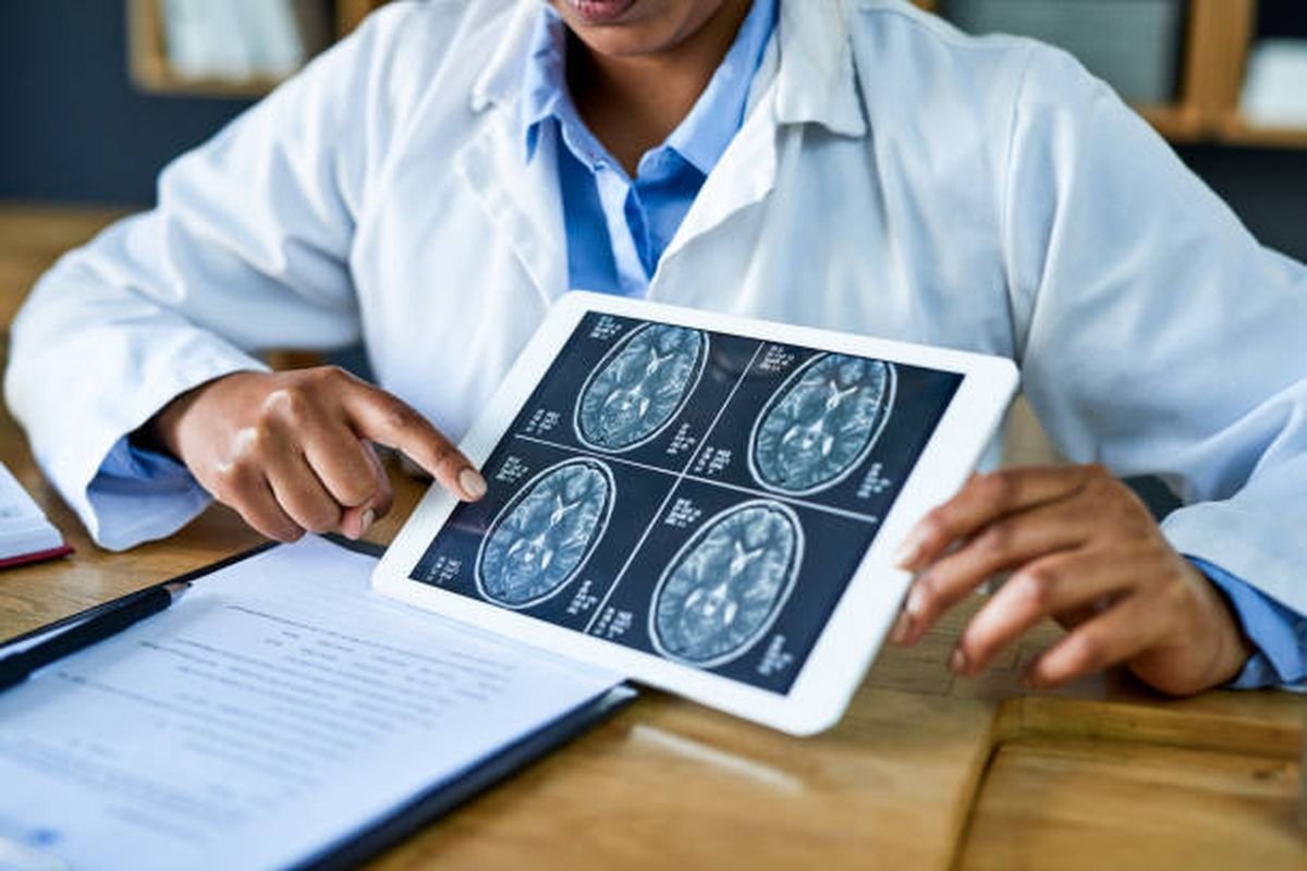“Tangkal Serangan Kedua: Dokter Ungkap Tips Cegah Stroke Berulang pada Pasien Moyamoya”