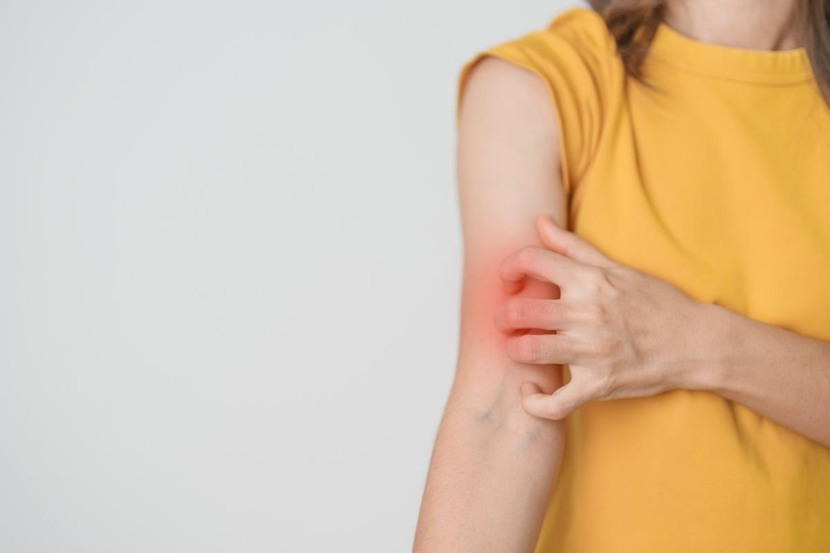 Lupus Bukan Akhir Dunia: Kenali Gejalanya dan Lawan dengan Penanganan Tepat