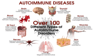 Penyakit Autoimun: Ketika Sistem Kekebalan Tubuh Menyerang Diri Sendiri